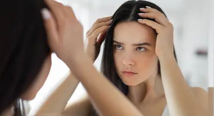 Tengo caspa: 3 consejos para eliminarla de raíz, según un dermatólogo