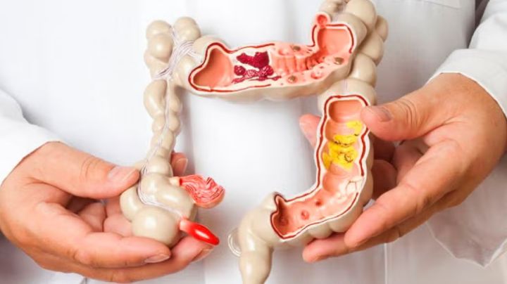 Estómago irritable: Estos 4 remedios caseros te ayudarán a calmar el malestar