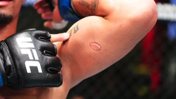 Se sintió Mike Tyson: Peleador de la UFC muerde a su rival y lo descalifican