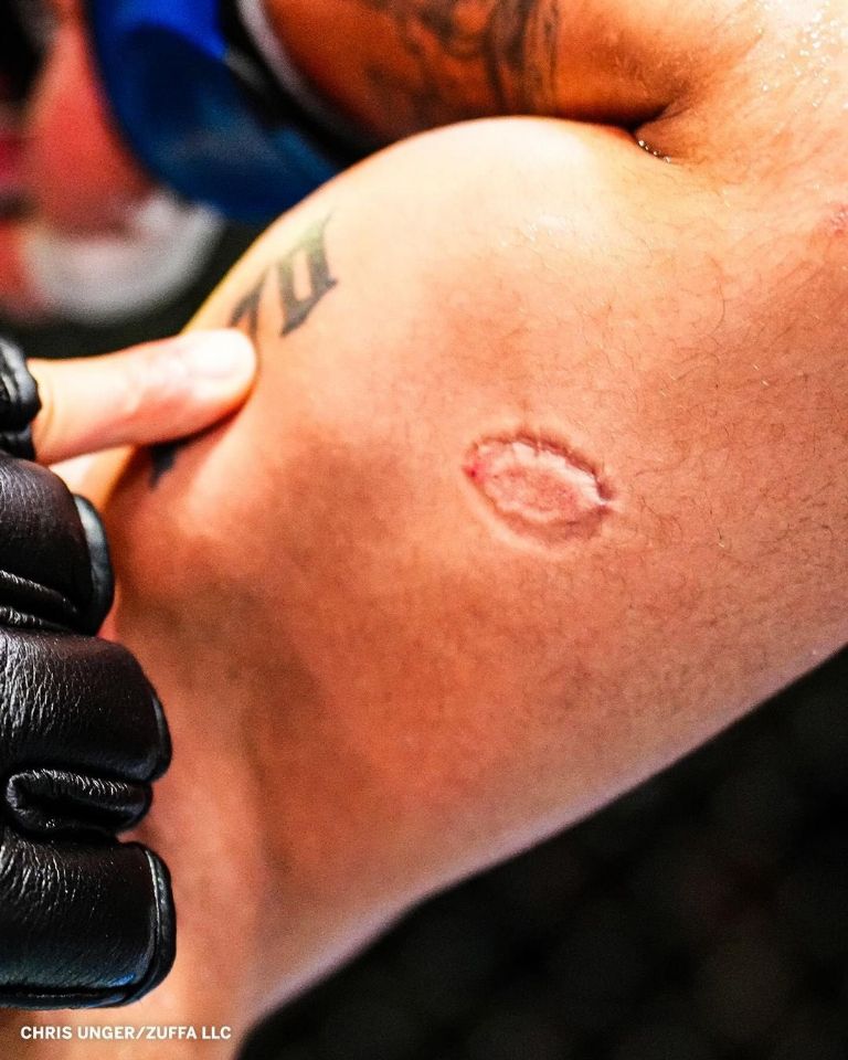 Peleador de la UFC muerde a su rival