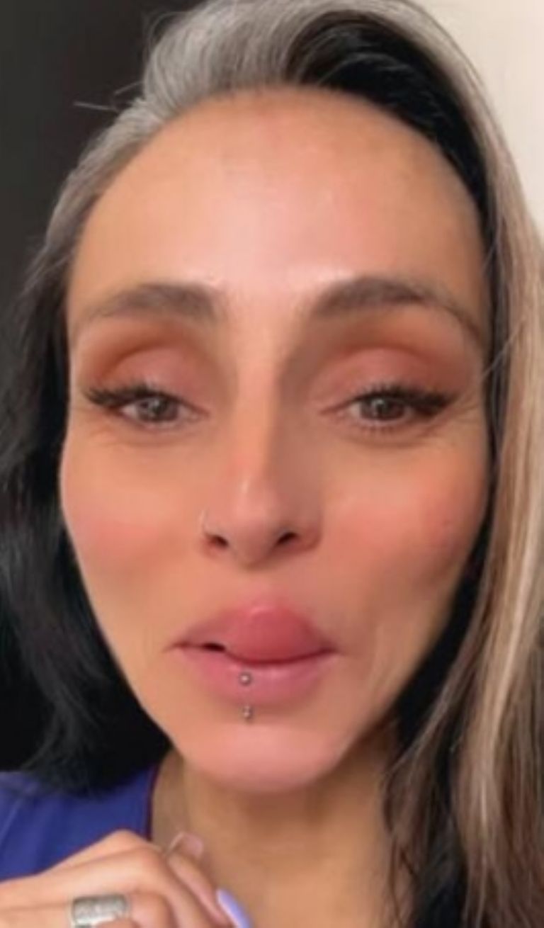 La hinchazón de su labio generó preocupación