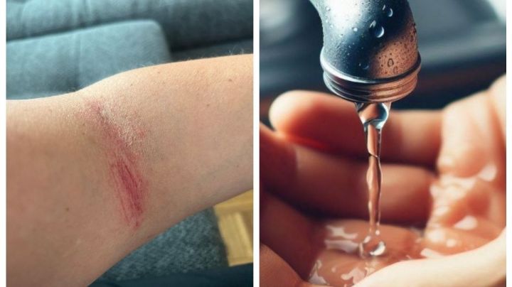 Vecina de Benito Juárez denuncia problemas de salud por agua 'potable' con olor a gasolina