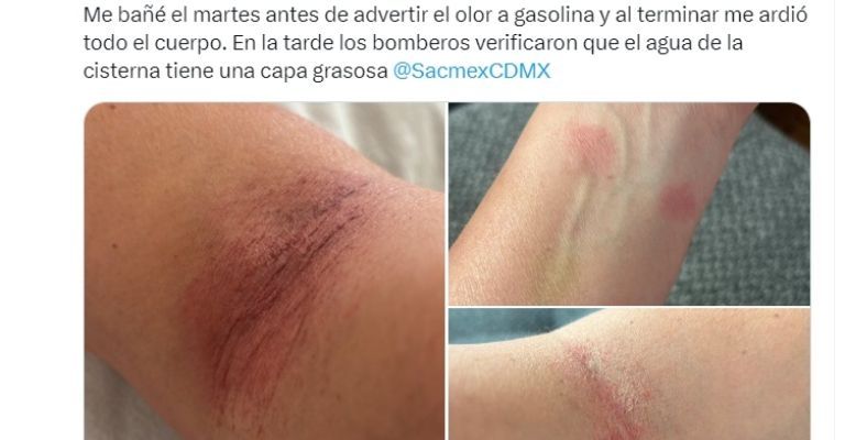 Vecina de Benito Juárez denuncia problemas de salud por agua con olor a gasolina