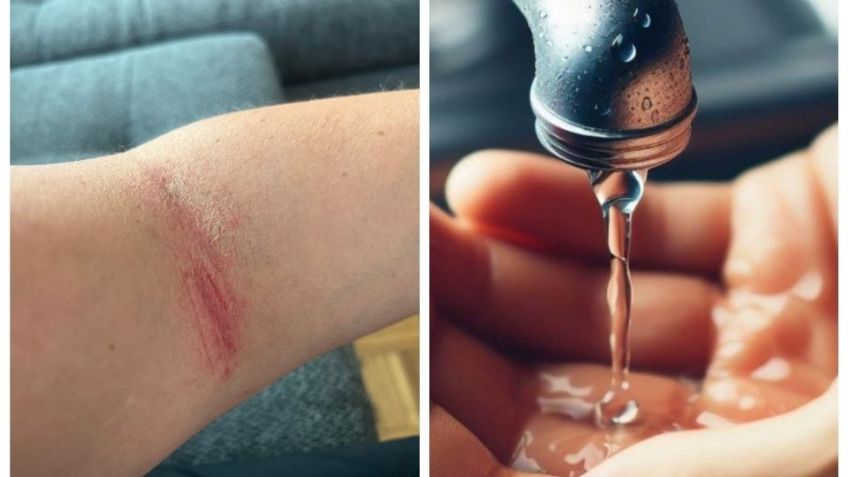 Vecina de Benito Juárez denuncia problemas de salud por agua 'potable' con olor a gasolina