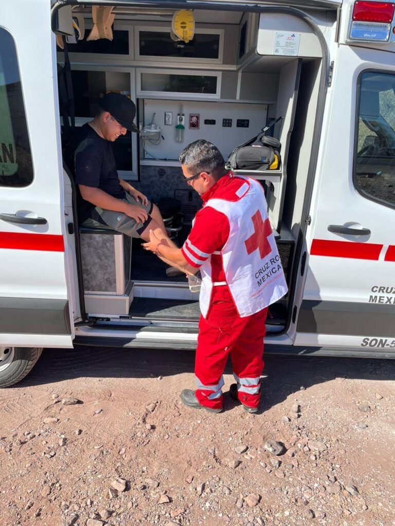 Picadura por mantarraya