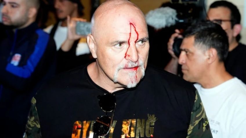 Violenta pelea entre equipos de Fury y Usyk previo al combate: John Fury resulta herido