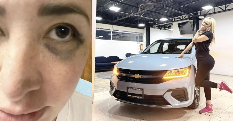 Damaris Rojas, exconductora de Hoy, sufre accidente y filtra terrible noticia