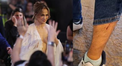 Seguridad de Jennifer Lopez agreden a reporteros de 'Sale el Sol'; le cortan la pierna