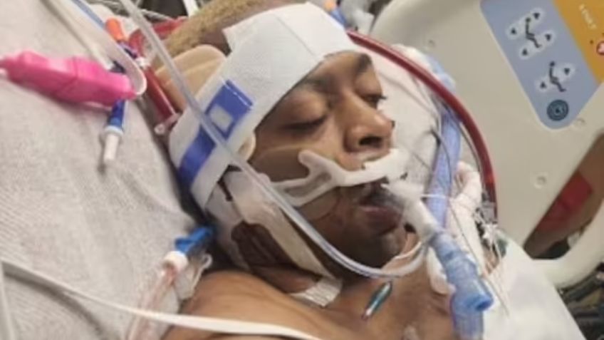 Jóvenes empujan a su amigo al agua en Estados Unidos; le provocaron daño cerebral