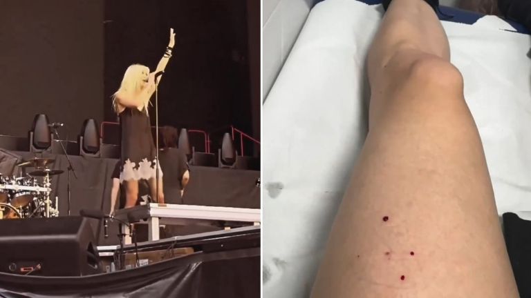 Taylor Momsen es mordida por murciélago