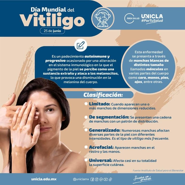 Día Mundial del Vitíligo 25 de junio
