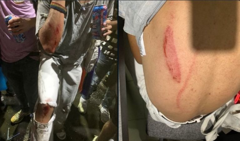 Atropellados en Zona Rosa