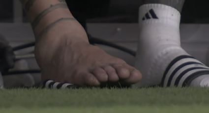 Así quedó el tobillo de Lionel Messi tras su escalofriante lesión en la Copa América