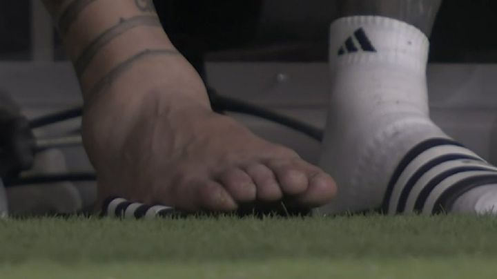 Así quedó el tobillo de Lionel Messi tras su escalofriante lesión en la Copa América