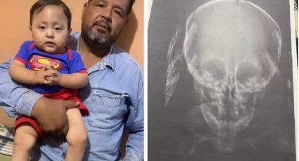 Familia del pequeño ‘Payito’ en Etchojoa pide apoyo para su costosa operación de cráneo