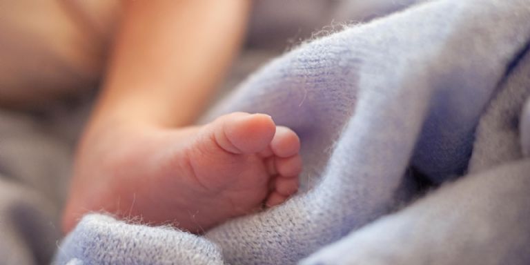 Nace bebé con rara condición