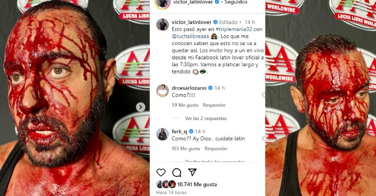 Latin Lover aparece ensangrentado tras golpiza y da duro mensaje