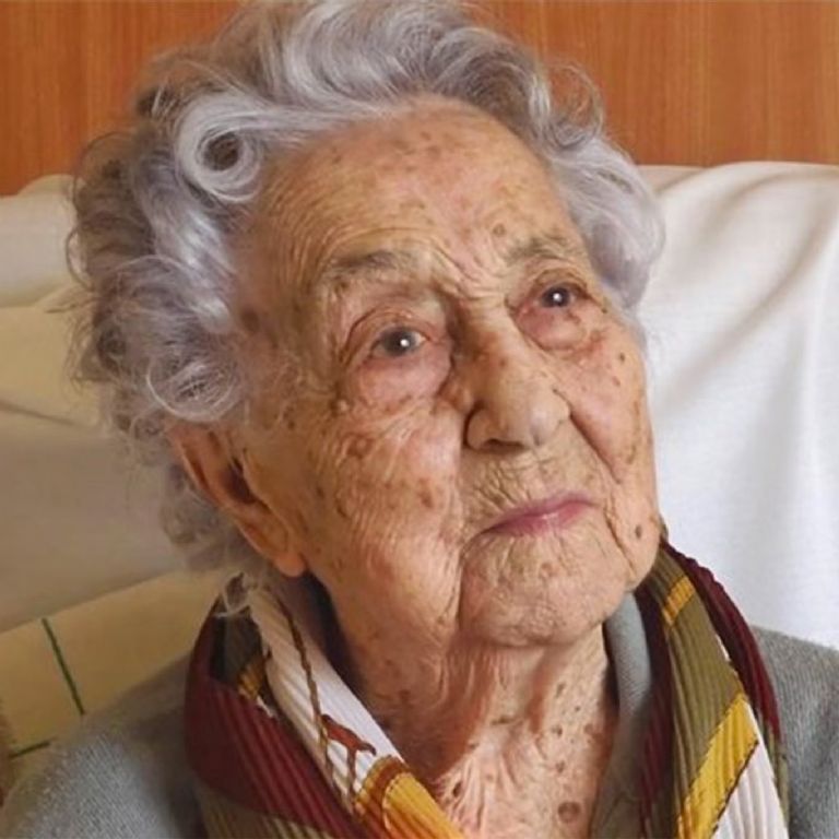 A su edad, sólo tenía pérdida en la audición y un poco de dificultad para moverse