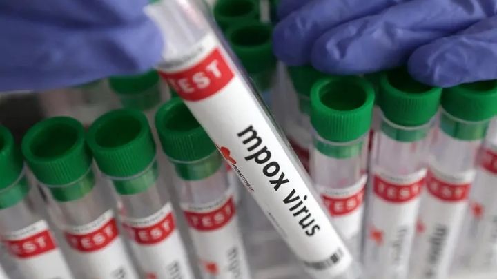 Viruela de mono en México: Refuerzan medidas contra Mpox en aeropuertos del Edomex