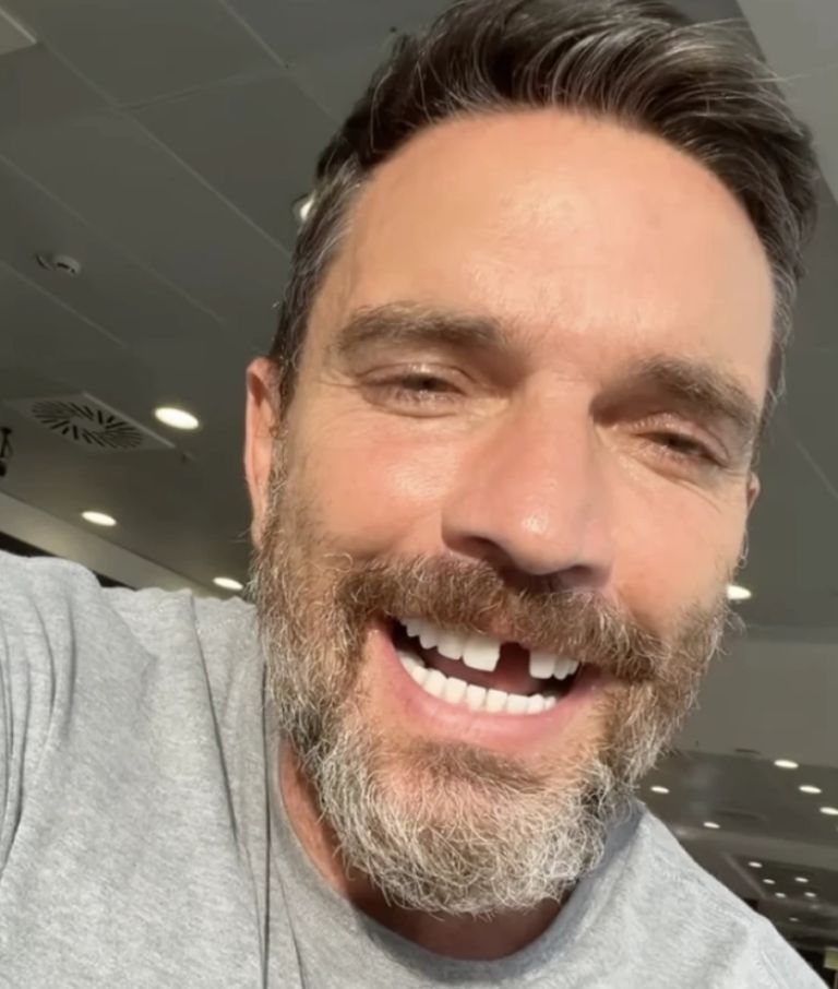 Compartió una foto con su sonrisa incompleta