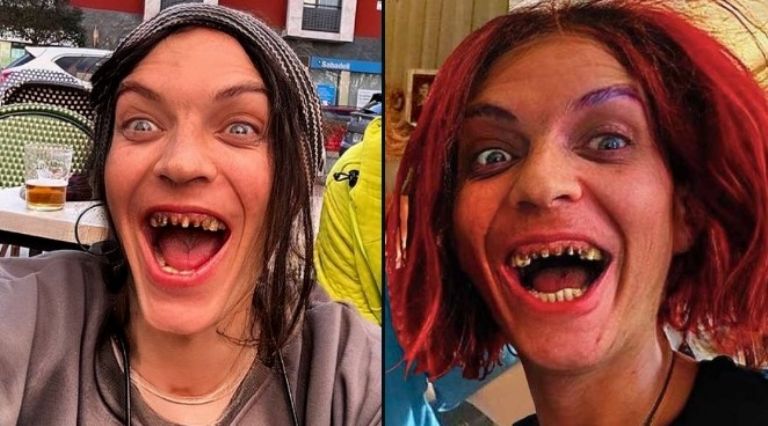 Camilo Blanes comparte perturbadora foto