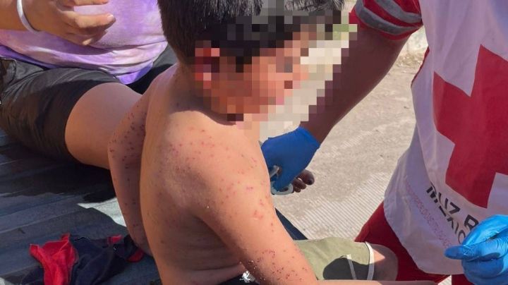 100 abejas atacan a niño de 6 años en Sinaloa; confirman su muerte en el hospital