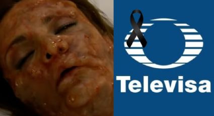 Desfigurada y deprimida: Tras cáncer y tumor, actriz de Televisa alista su muerte y da dura noticia