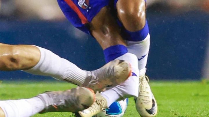 VIDEO: Así fue la brutal lesión de Christian 'Hobbit' Bermúdez en la Liga Expansión