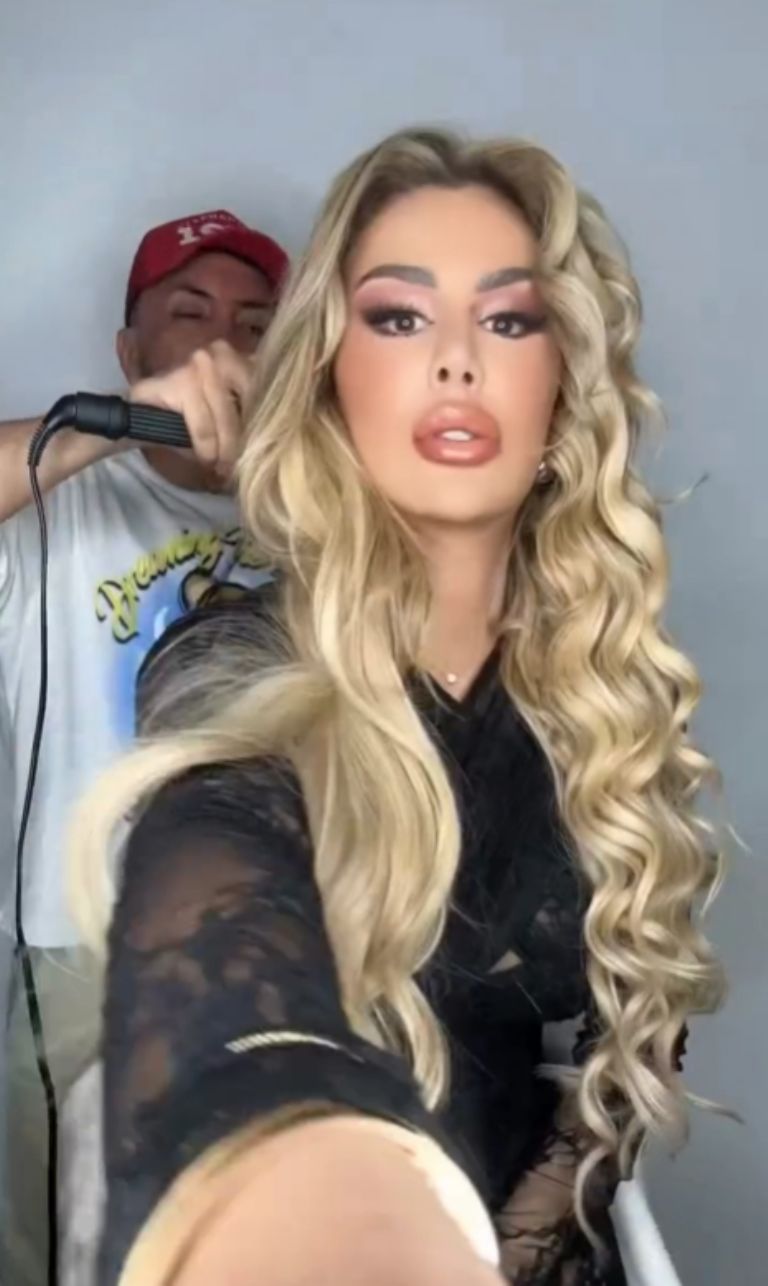 Se especula que Conde viajó a Turquía para someterse a cirugías estéticas