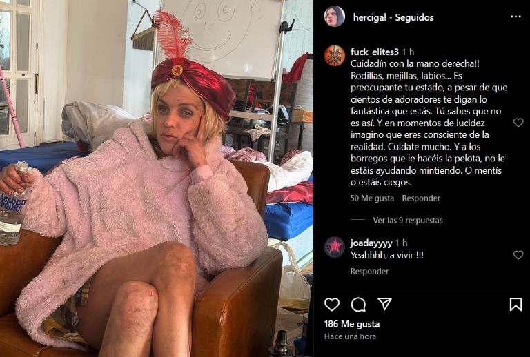 Hijo de Camilo Sesto preocupa a fans por marcas en las rodillas