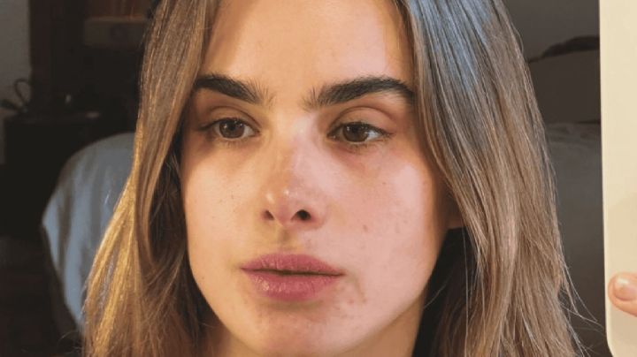 Tras 'LCDLFM', Gala Montes confirma que padeció dismorfia y revela cómo logró superarla