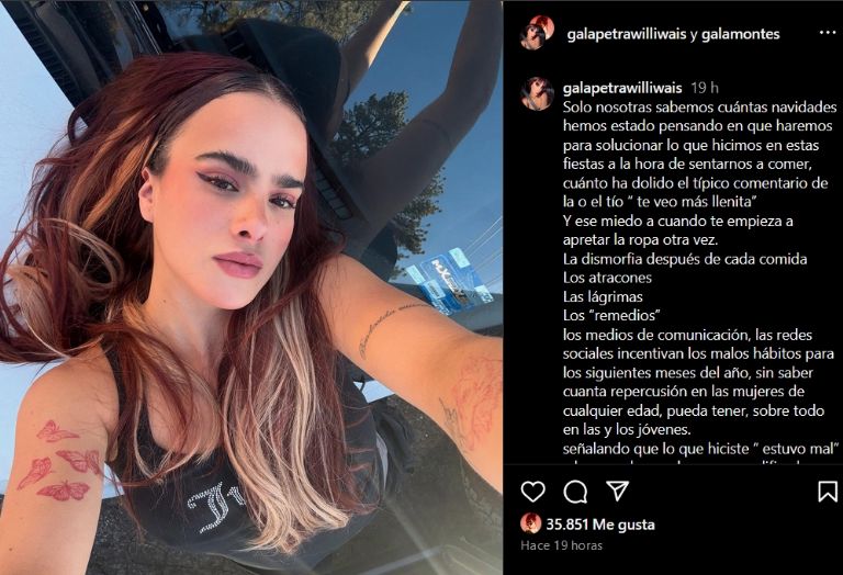 Gala Montes confirma que padeció dismorfia