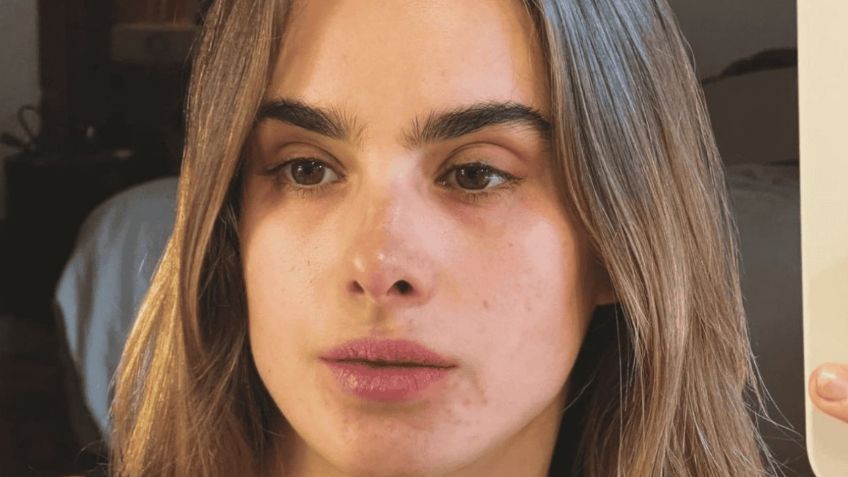 Tras 'LCDLFM', Gala Montes confirma que padeció dismorfia y revela cómo logró superarla