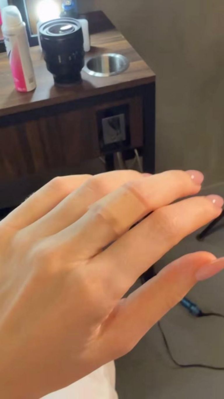 Se lastimó un dedo de la mano 