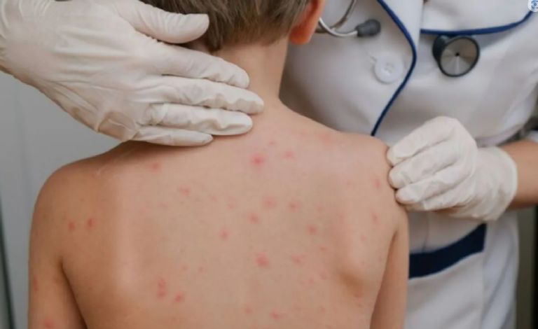 Aseguran que están disminuyendo los casos 