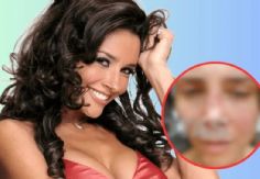 Foto ilustrativa de nota Famosa actriz de Televisa acaba desfigurada tras mala cirugía estética; filtran impactantes FOTOS