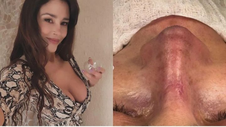 La modelo argentina Dorismar termina desfigurada después de cirugía estética y más en  Tribuna Top 3 Espectáculos