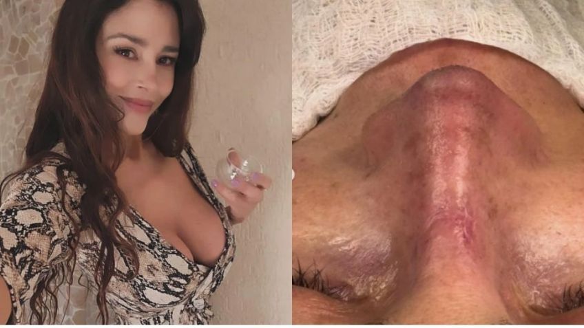La modelo argentina Dorismar termina desfigurada después de cirugía estética y más en  Tribuna Top 3 Espectáculos