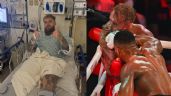 Foto ilustrativa de la nota titulada: Anthony Joshua causa fractura en Jake Paul; el influencer tuvo que ser operado de emergencia