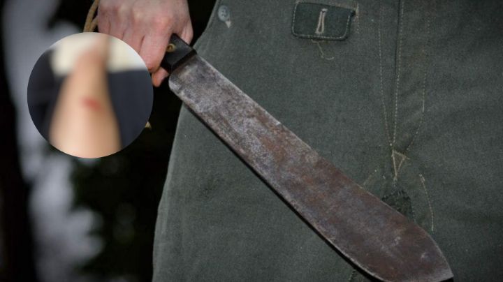 (IMÁGENES SENSIBLES) Horror en Ciudad Obregón: Mujer es atacada a machetazos al tirar la basura