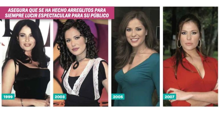 Arleth Terán así luce tras sus arreglitos estéticos