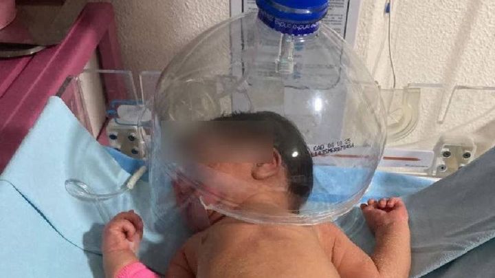 Personal médico usa garrafón para oxigenar a neonato en Tabasco; funcionarios suspendidos