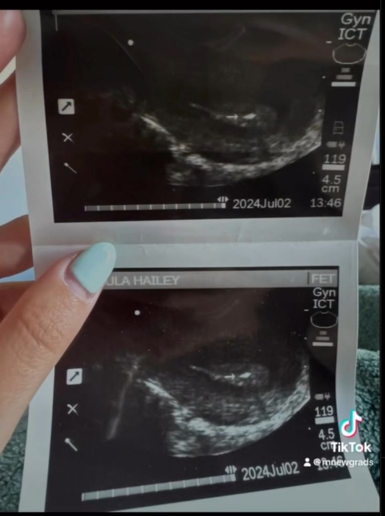 Hailey muestra a sus seguidores sobre su embarazo. /Créditos: Instagram