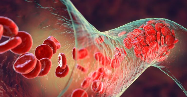 La salud arterial es importante