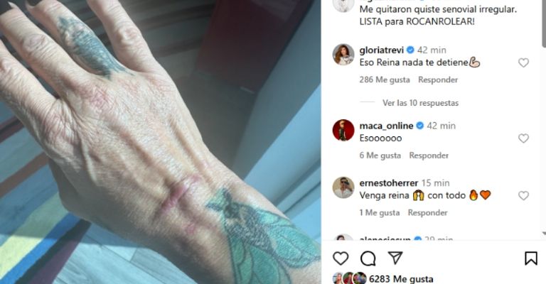 Alejandra Guzmán aclara el motivo de su operación y su estado de salud