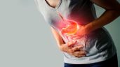 Foto ilustrativa de la nota titulada Alimentos irritantes que agravan la gastritis silenciosamente y pasan desapercibidos