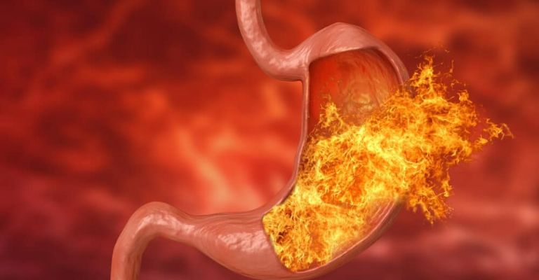 Lo que debes saber acerca de la gastritis