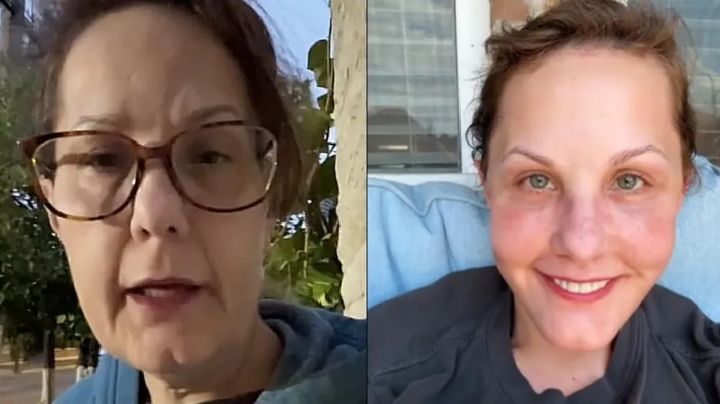 Mujer estadounidense documenta cirugía en Guadalajara y se vuelve tendencia en TikTok