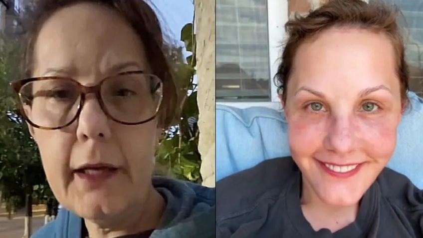 Mujer estadounidense documenta cirugía en Guadalajara y se vuelve tendencia en TikTok