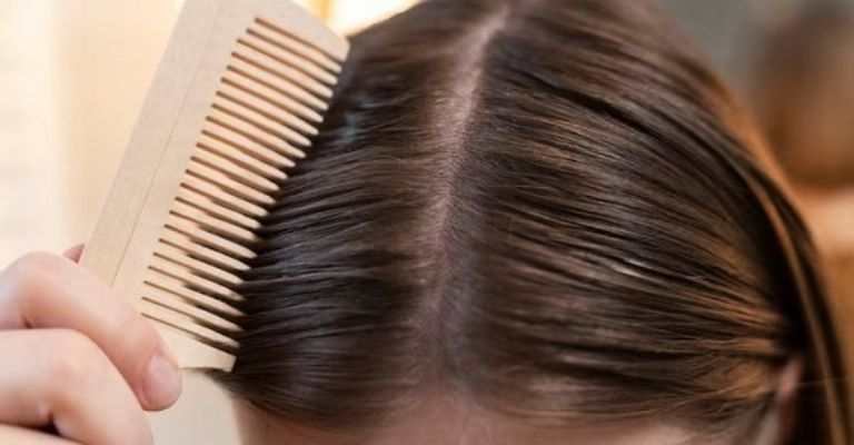 Deja el cabello libre de grasa y caspa